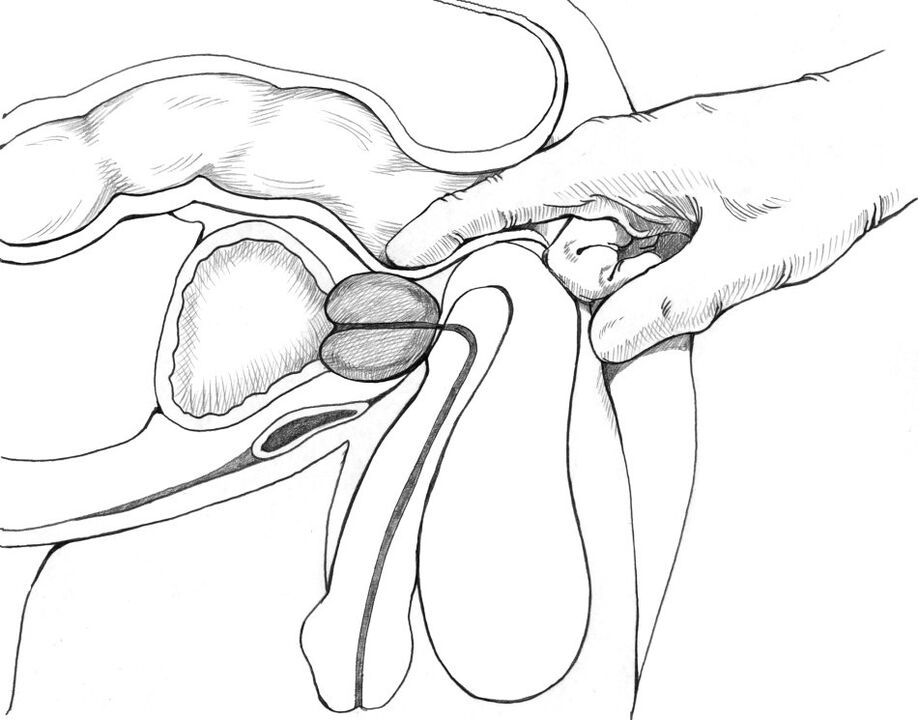 Prostata Massage ass am Komplex vu Prostatitis Behandlungsmethoden abegraff